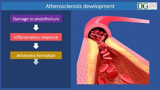 David Game College  Atherosclerosis [upl. by Neztnaj]