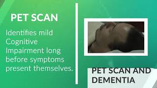 Can a PET scan detect Alzheimers Disease or Dementia [upl. by Llertram1]