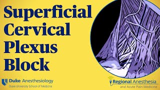 Superficial cervical plexus block [upl. by Ayanet]