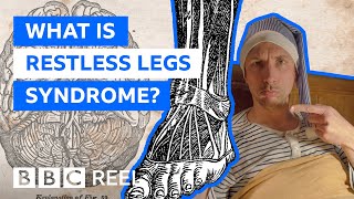 What is restless legs syndrome and why does it matter  BBC REEL [upl. by Madda140]