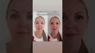 Here’s What Happened After a Year of Facial Exercises facegym facialmassage faceexercise face [upl. by Othe126]