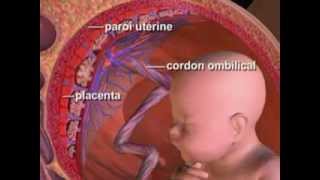 Biopsie Des Villosités Choriales  Technique Et Indications [upl. by Billmyre]