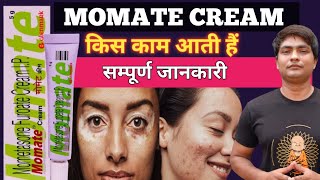 momate cream for skin  momate cream  momate cream uses in hindi  momate cream review [upl. by Odnarb]