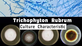 Trichophyton Rubrum culture Characteristic [upl. by Eibur666]