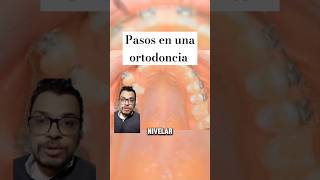 ORTODONCIA Expansor del Paladar odontologia [upl. by Fennelly]