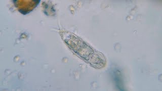 Probably a Cephalodella Rotifer  swimming around and eating  100x 400x [upl. by Crispen]