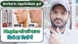 Berberis Aquifolium gel use dose benefits and Side effects full review in hindi [upl. by Ymmaj]