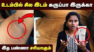 கருமை போக தினமும் இத பண்ணுங்க  Underarm Darkness  Neck Darkness  Skin care [upl. by Ahslek]