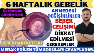 6 Haftalık Gebelik 2023 [upl. by Studnia355]