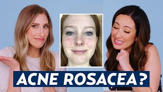 Can You Have Acne AND Rosacea Dermatologist Reacts to Danas Skincare Routine  DERM REACTS [upl. by Darsey112]