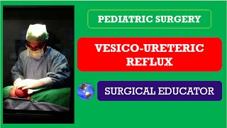 VESICO URETERIC REFLUX How To DIAGNOSE amp TREAT Pediatric Surgery [upl. by Willard]