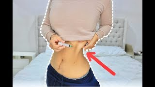 COMO REDUCIR ABDOMEN Y CINTURA con mesoterapia  lipo sin cirugía [upl. by Laehcar]