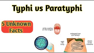 Difference between typhoid and paratyphoid [upl. by Beffrey]