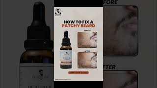 Want to fix a patchy beard 🧔‍♂️ beardcareroutine beardgrooming beardgoals [upl. by Fahland]