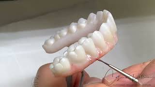 Implant Bridges Zirconia Monolithic Double Full Arch Tutorial [upl. by Schell848]