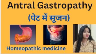 Antral Gastropathy पेट में सूजन treatment  Antral gastritis symptomscause amp homeopathic medicine [upl. by Iny]