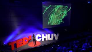 These cells in your brain might heal you some day  Jocelyne Bloch  TEDxCHUV [upl. by Mylander497]