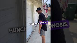 Improve Bad Posture Hunchback amp Kyphosis with 1 simple stretch ￼ [upl. by Ramej]