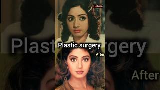 Mysterious Death Of Sridevi mysterious siridevi bonykapoor death sunodigital [upl. by Tuddor]