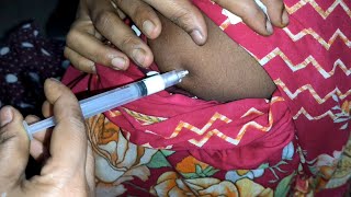 Arm IM Soma Ject Injection Push √√ Injection Videoজন্মবিরতিকরণ ইনজেকশন Ep 45 Injection Vision [upl. by Pru]