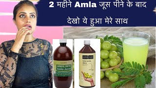 Benefits for amla juicealoevera juiceamla juice ke fayedekapiva amla and aloevera juice [upl. by Kramlich]