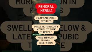 Femoral Hernia [upl. by Barbour]