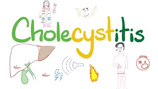 Cholecystitis  A Tale of One Cholelith  The most COMPREHENSIVE Review [upl. by Fellows850]