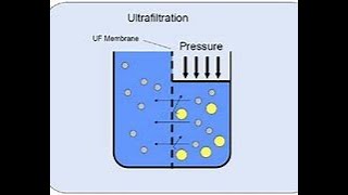 10 28 22 Ultrafiltration in hemodialysis patients [upl. by Yttap228]