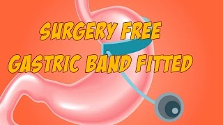 Surgery Free Gastric Band Fitted Hypnosis Session [upl. by Landers]