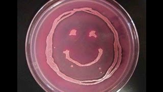 How to Interpret MacConkeys Agar Bacterial Growth Medium [upl. by Atinaujnas40]