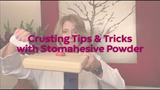 Crusting Tips and Tricks with Stomahesive Powder [upl. by Anna-Diane]