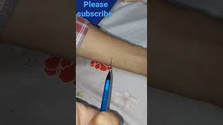 Injection 💉 using pen pencil ✏🤩 Hack version shorts [upl. by Anisirhc]