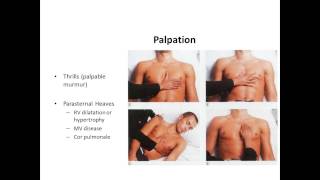 Cardiac Examination in clinical medicine [upl. by Uyerta]