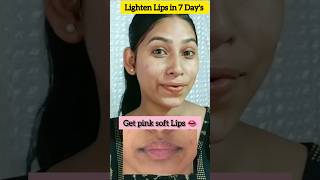 Get Rid of Dark Lips Naturally ✨👄 shorts lipsbeauty youtubeshorts viralshort lipscare lips [upl. by Girhiny938]