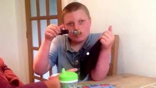 Angelman Syndrome  Samuel feeds himself very carefully [upl. by Anoiuq]