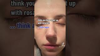 Watch this genius rosacea treatment [upl. by Xerxes]