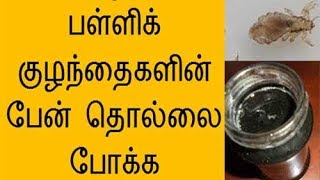 Lice Treatment in Tamil  Best home remedy for lice [upl. by Rehprotsirhc463]