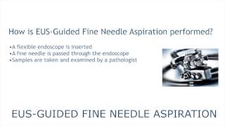 EUSGuided Fine Needle Aspiration [upl. by Akienom698]