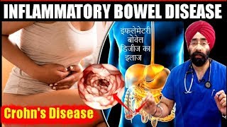 DIET for IBD  Crohns Disease का मेडिकल कारन और इलाज  Explained in HIndi by DrEducation [upl. by Yrac]