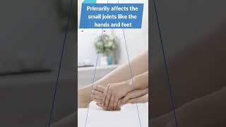 What does Rheumatoid arthritis affect [upl. by Nyasuh]