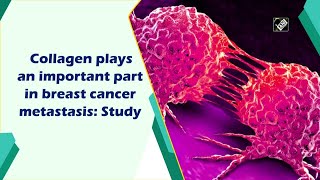 Collagen plays an important part in breast cancer metastasis Study [upl. by Acacia]