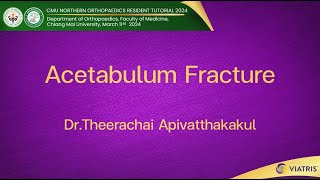 Acetabulum Fracture [upl. by Lewiss588]