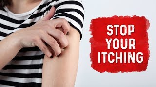 What Causes Hives and Itchiness  Urticaria Hives Treatment  Dr Berg [upl. by Heidt429]