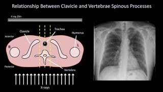 How to Interpret a Chest XRay Lesson 3  Assessing Technical Quality [upl. by Kirst]