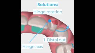 Hinge Rotation Explained [upl. by Nathanoj53]