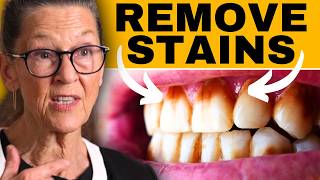 How to remove stains on teeth athome [upl. by Irbua]