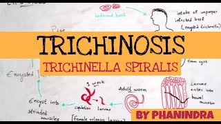 TRICHINOSIS  TRICHINELLA SPIRALIS  STRUCTURE  LIFE CYCLE  SYMPTOMS  BY PHANINDRA GUPTA [upl. by Essirahs884]