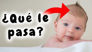 ¿Cómo ELIMINAR la COSTRA LÁCTEA en bebés 👶 [upl. by Ailaham459]