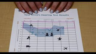 How to read an audiogram [upl. by Ycal285]