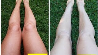 How To Remove Sun Tan Instantly  Sun Tan Removal Home Remedies [upl. by Ennaharas]